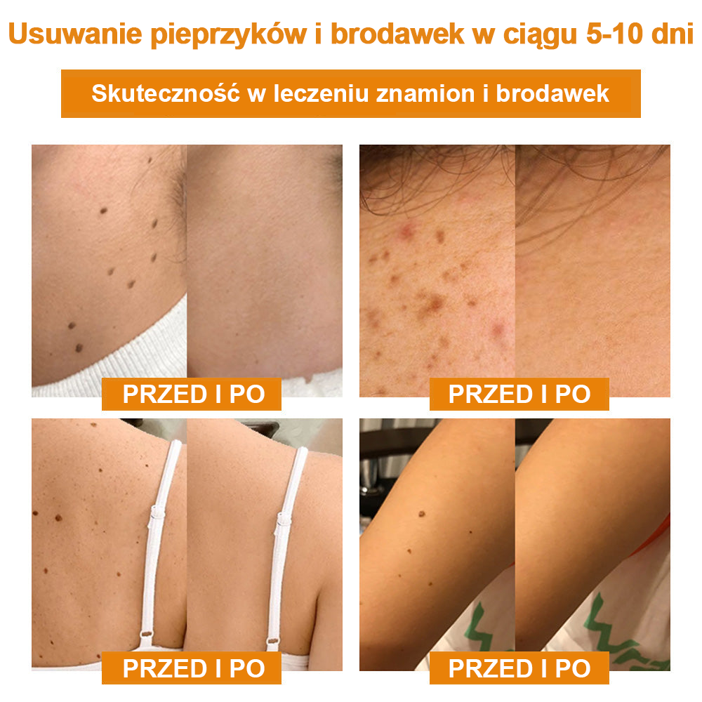 🎁 Zostały już tylko 5 pudełek! Oferujemy dodatkowy rabat 50%!