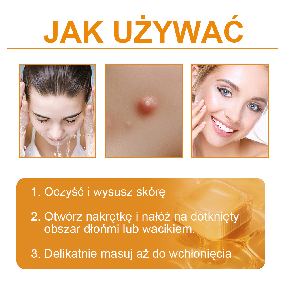 修改💥𝑻𝒖𝒓𝒐𝒏𝒖™Velim Jędom Odsłanenię Bradavič Znamionok Krem (🧑‍⚕️AAD Rekomenduje)🐝🐝(🔥Promocja ostatniego dnia - 70% rabatu)🔥💥 (Copy)