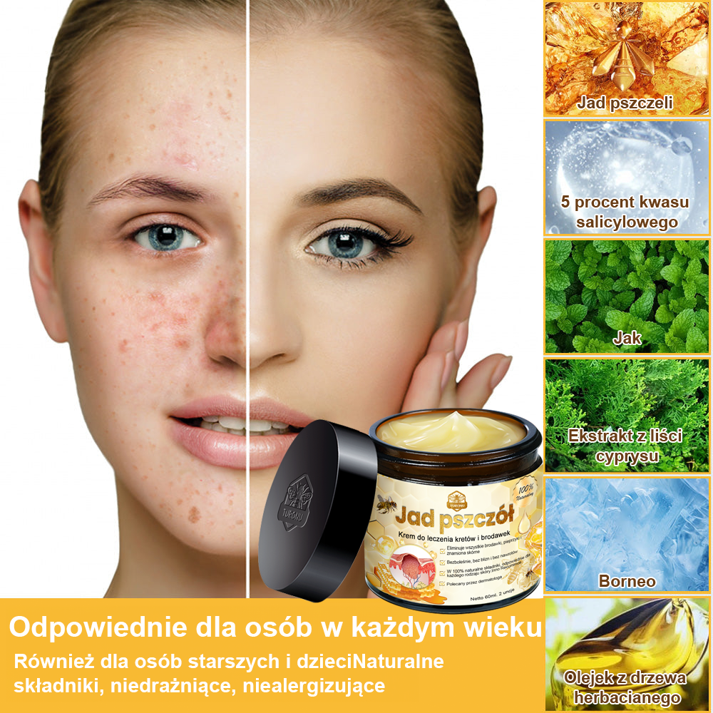 修改💥𝑻𝒖𝒓𝒐𝒏𝒖™Velim Jędom Odsłanenię Bradavič Znamionok Krem (🧑‍⚕️AAD Rekomenduje)🐝🐝(🔥Promocja ostatniego dnia - 70% rabatu)🔥💥 (Copy)