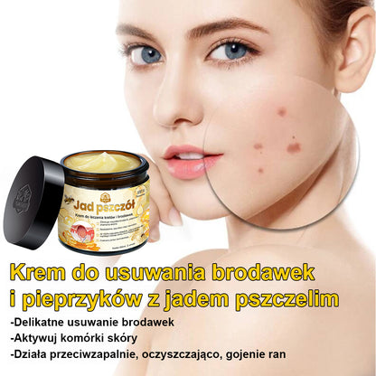 修改💥𝑻𝒖𝒓𝒐𝒏𝒖™Velim Jędom Odsłanenię Bradavič Znamionok Krem (🧑‍⚕️AAD Rekomenduje)🐝🐝(🔥Promocja ostatniego dnia - 70% rabatu)🔥💥 (Copy)