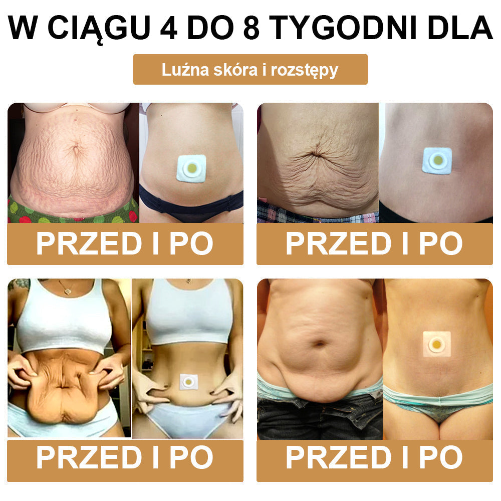 🎊 Dooeka™ Bee Venom Limfatyczny Plaster Oczyszczający Slimming Patch 🔥 Ograniczony czas! 70% ZNIŻKI! (Dostępne tylko dla indywidualnych zakupów) 🔥 (Copy)