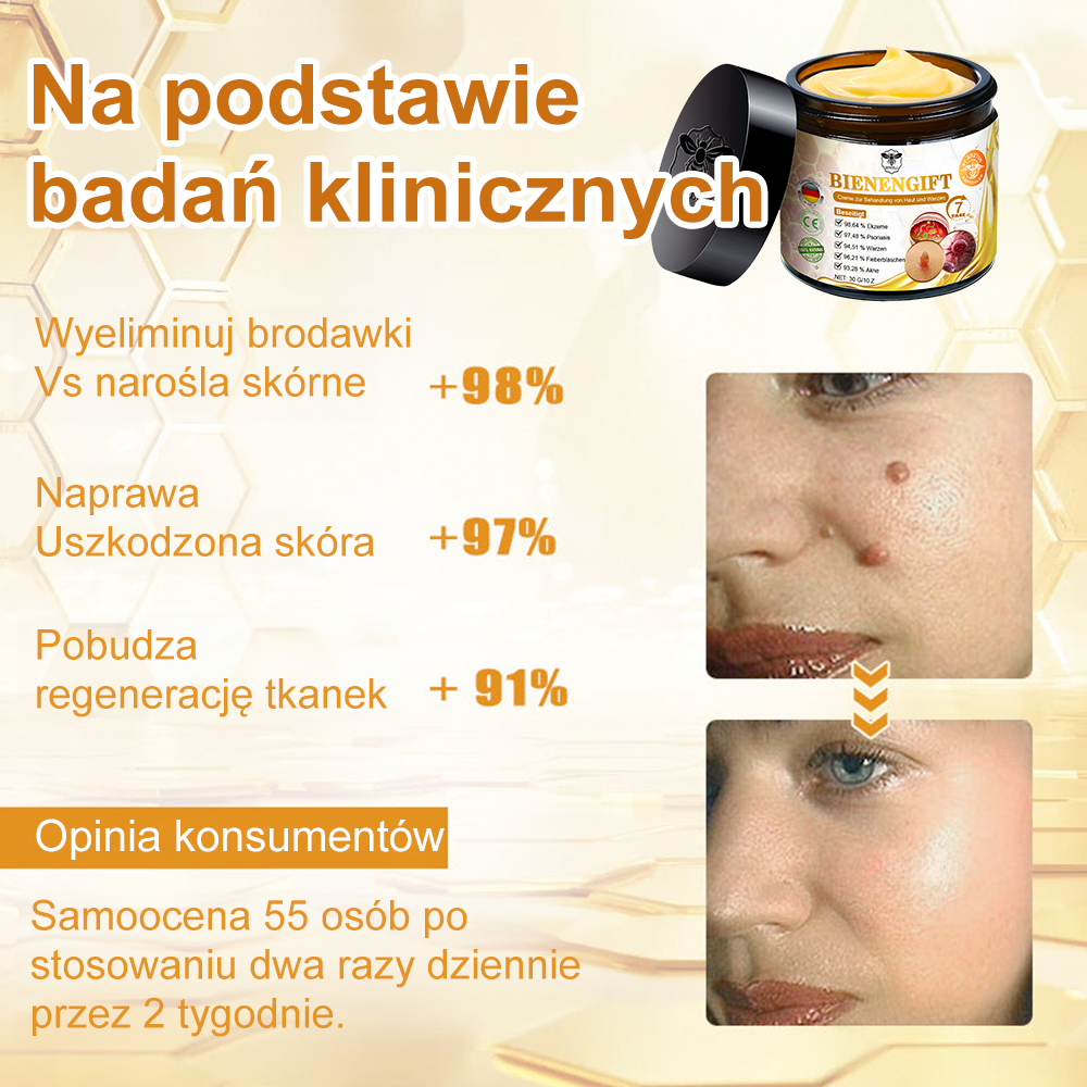 修改💥𝑻𝒖𝒓𝒐𝒏𝒖™Velim Jędom Odsłanenię Bradavič Znamionok Krem (🧑‍⚕️AAD Rekomenduje)🐝🐝(🔥Promocja ostatniego dnia - 70% rabatu)🔥💥 (Copy)