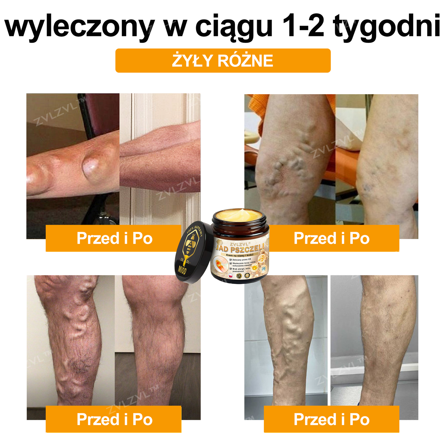 🎄 Świąteczna Oferta 🎄 Złóż zamówienie teraz i ciesz się rabatem do 70%! Pierwsze 500 klientów codziennie otrzyma promocję "kup jeden, drugi gratis". Szybko skorzystaj!