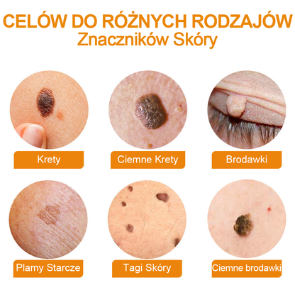 修改💥𝑻𝒖𝒓𝒐𝒏𝒖™Velim Jędom Odsłanenię Bradavič Znamionok Krem (🧑‍⚕️AAD Rekomenduje)🐝🐝(🔥Promocja ostatniego dnia - 70% rabatu)🔥💥 (Copy)