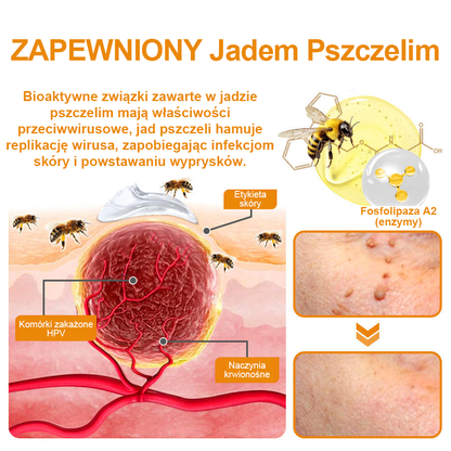 修改💥𝑻𝒖𝒓𝒐𝒏𝒖™Velim Jędom Odsłanenię Bradavič Znamionok Krem (🧑‍⚕️AAD Rekomenduje)🐝🐝(🔥Promocja ostatniego dnia - 70% rabatu)🔥💥 (Copy)