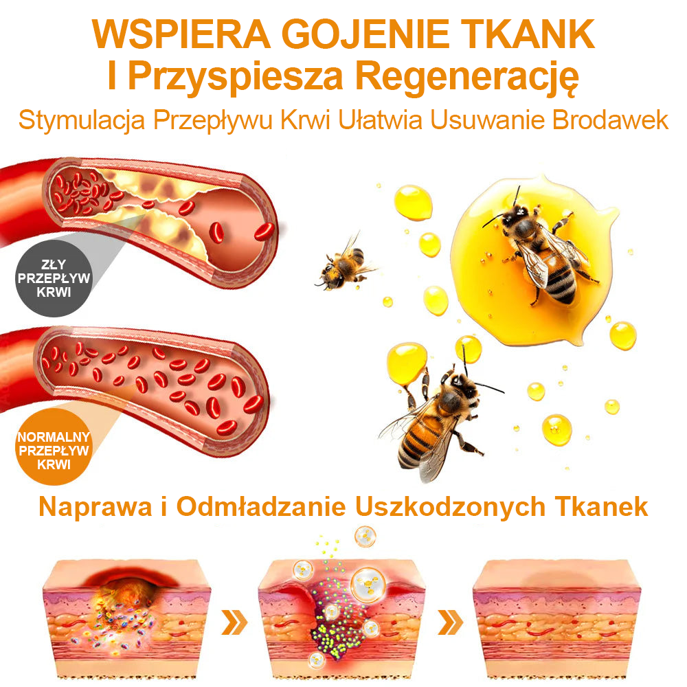 修改💥𝑻𝒖𝒓𝒐𝒏𝒖™Velim Jędom Odsłanenię Bradavič Znamionok Krem (🧑‍⚕️AAD Rekomenduje)🐝🐝(🔥Promocja ostatniego dnia - 70% rabatu)🔥💥 (Copy)